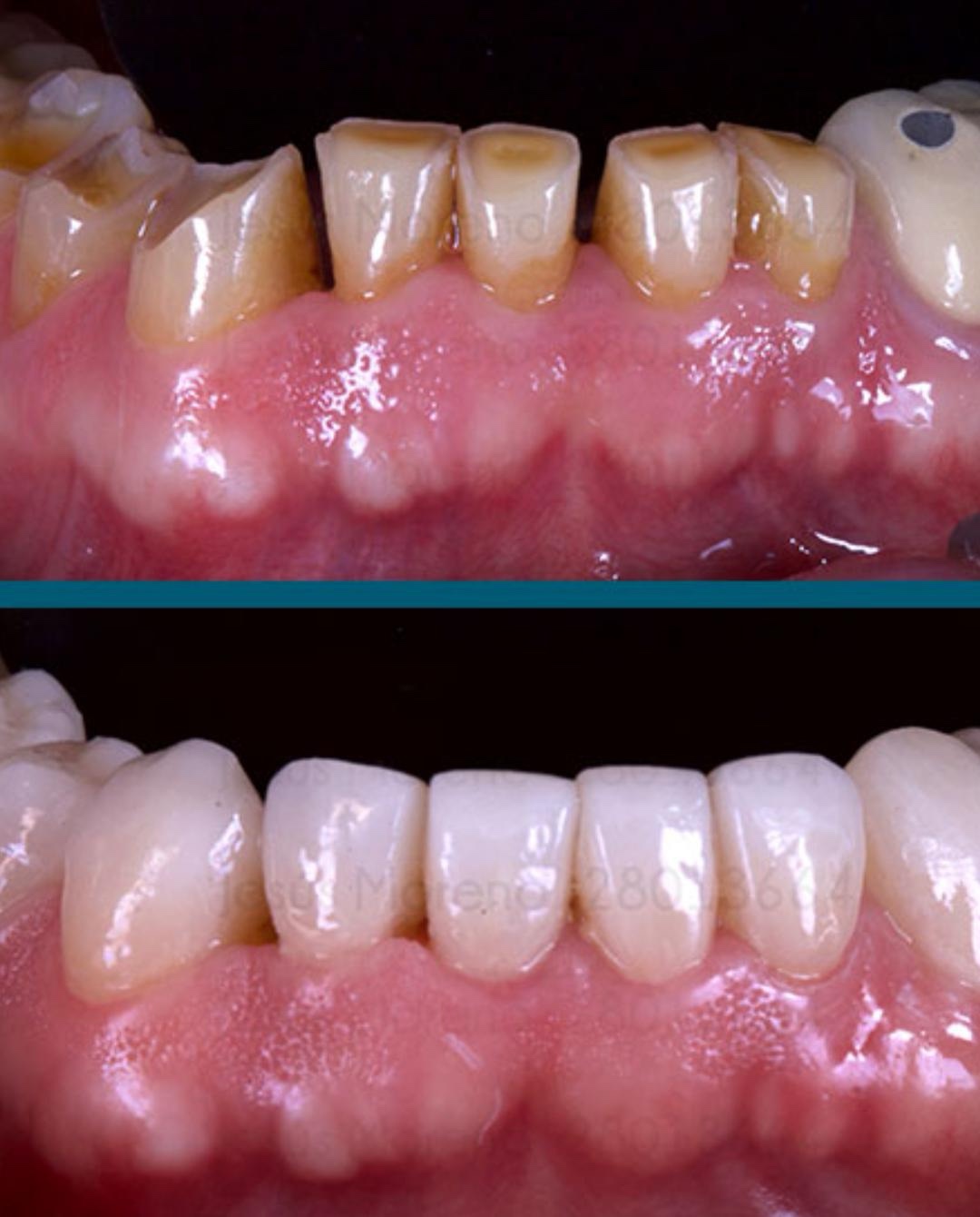 Imagen dental antes y después