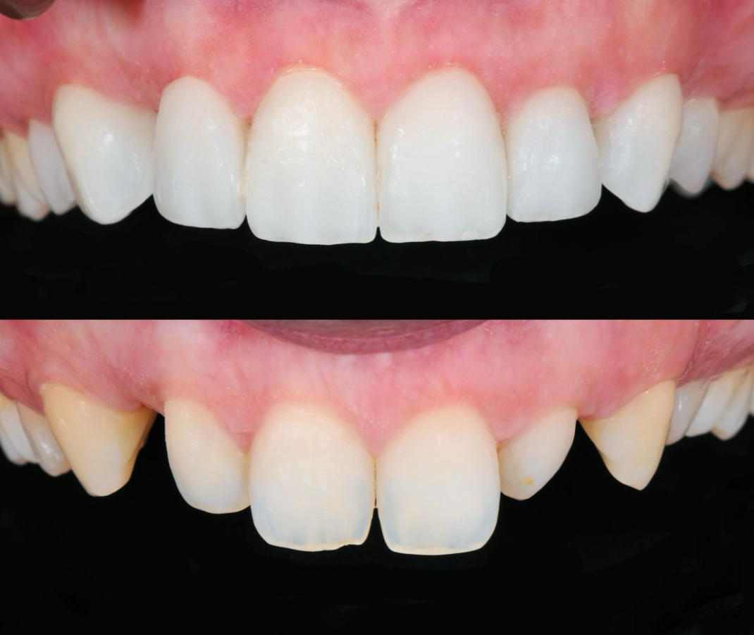 Imagen de estética dental