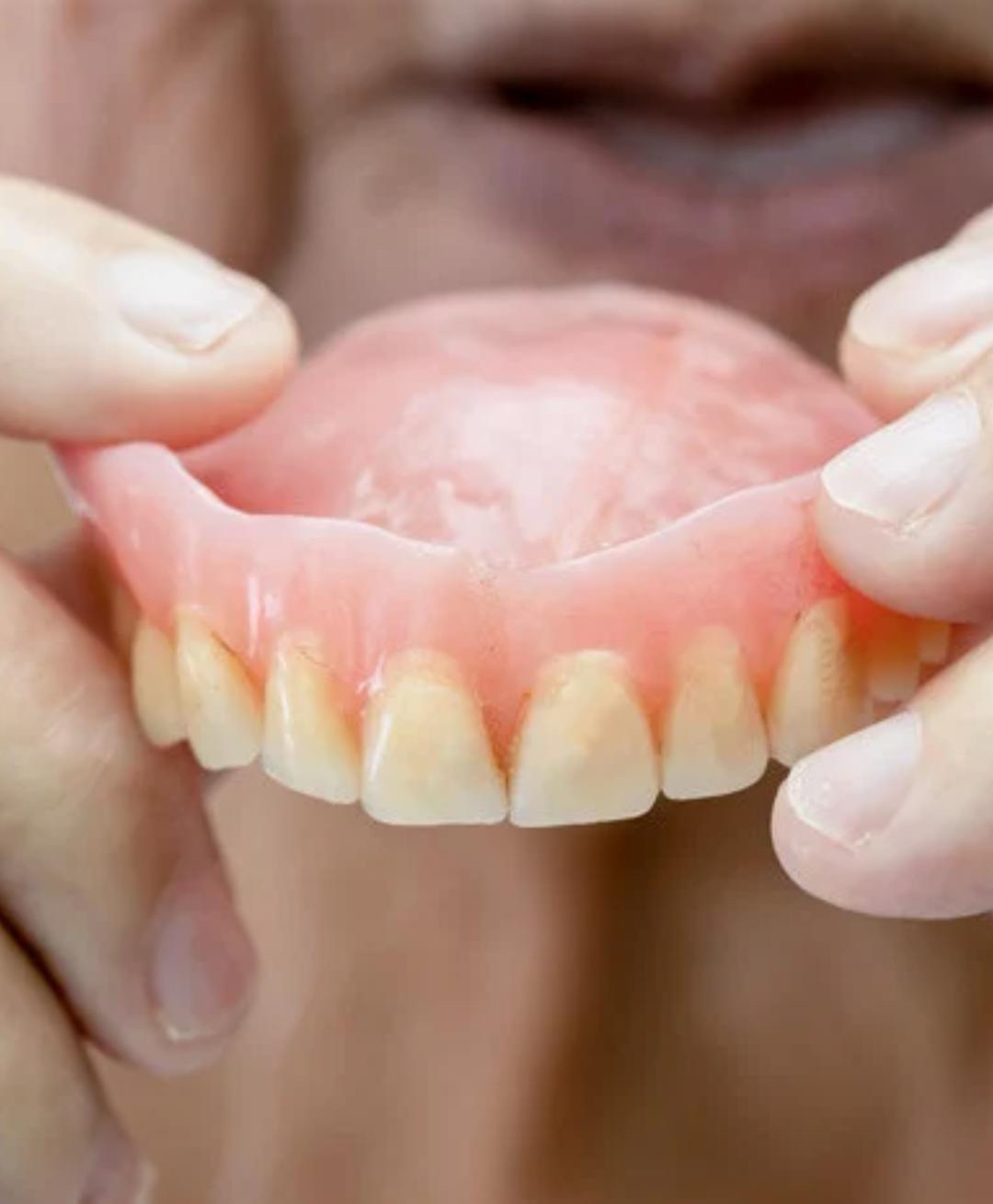 Imagen de prótesis dental removible